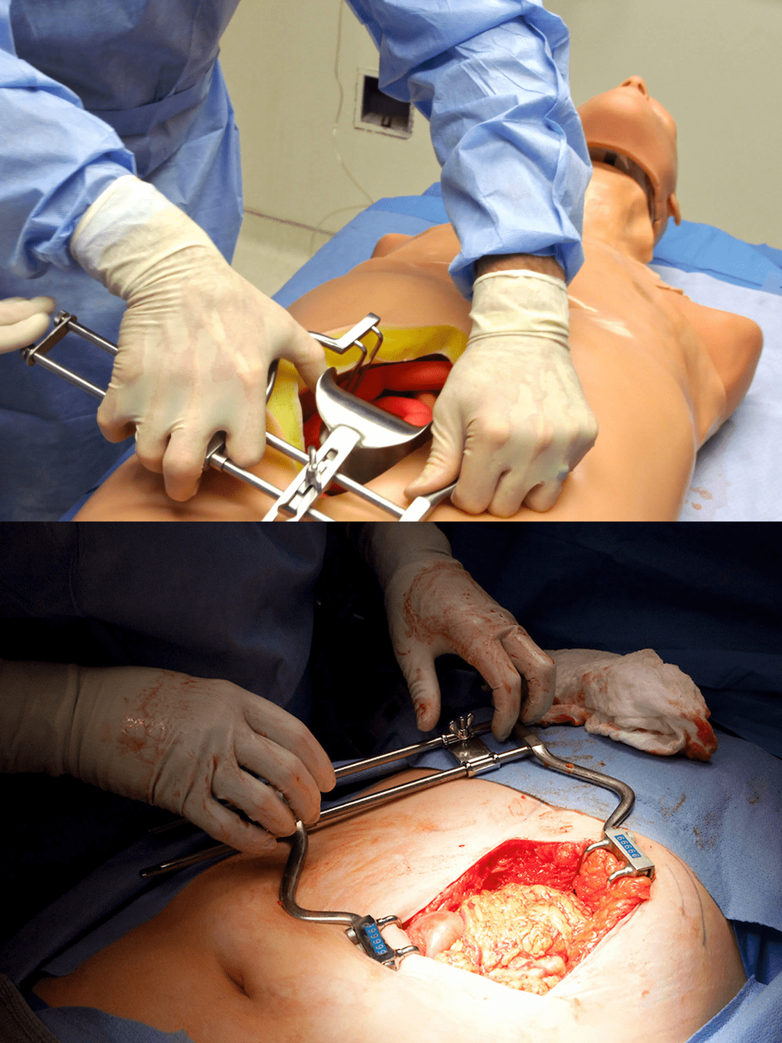 Simulab Abdominal